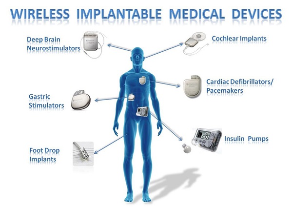 圖三 : 可植入式無線醫療設備已大量使用於人體中，這使得使用安全性更受重視。