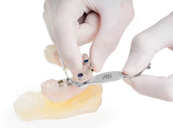 圖一 : 以3D列印生產的牙科手術導板，引導牙醫師到定位出最適當的角度、位置與深度，以更精準的完成手術。（圖／明碁口腔醫材）