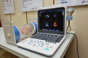 佳世達可攜式觸控醫療診斷超音波