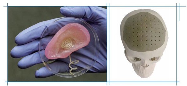 圖三 : 3D列印特別適合單一客製化的醫療市場，特別是在修飾性的身體組織列印。