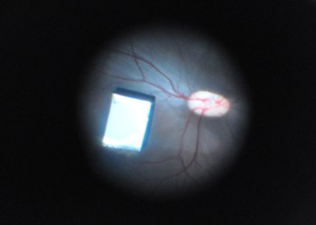 图1 : 猪眼植入生物视网膜设备