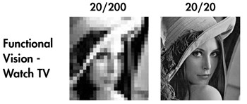 圖2 : （左）第一代生物視網膜植入後所呈現的影像。（右）相同影像在第二代生物視網膜版上呈現的影像。