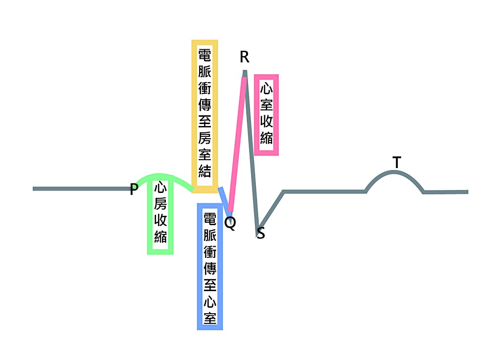 此為心電圖，心臟去極化運作順序。(繪圖／林彥伶)