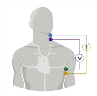 圖2 : 人體器官生物阻抗測量方法