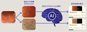 Olympus的EndoBRAIN是在日本國內首次作為醫療器材獲得批准的使用AI輔助診斷的內視鏡軟體。(source:Olympus)